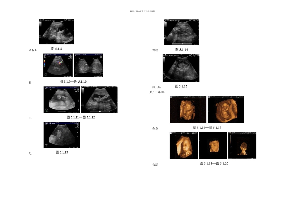 正常妊娠和异常妊娠超声诊断_第2页
