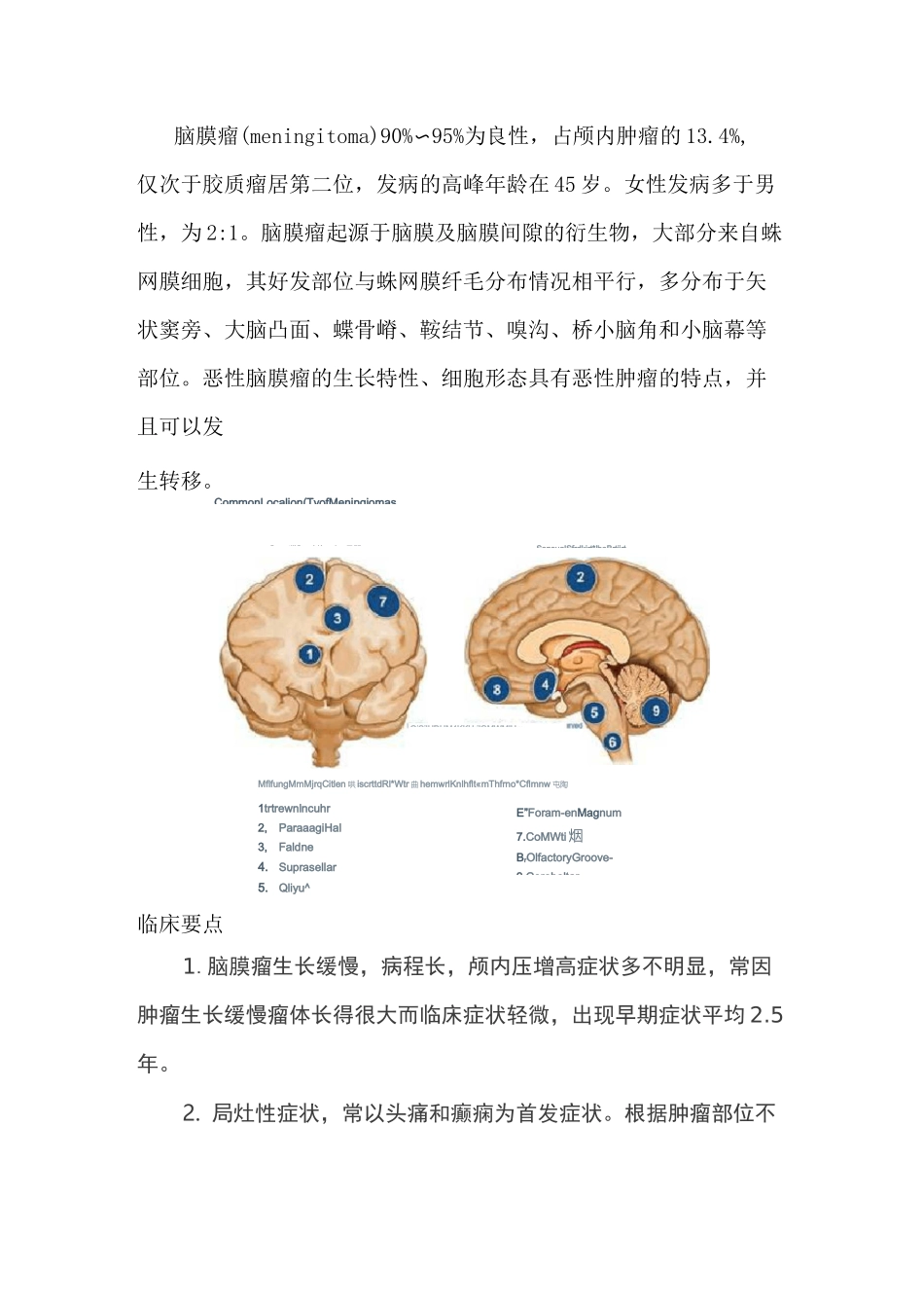 脑膜瘤病理分型及典型影像表现_第1页