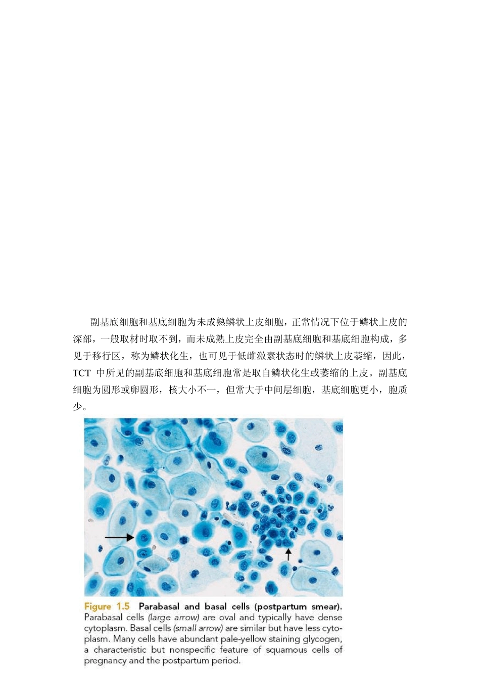 宫颈液基细胞学_第2页