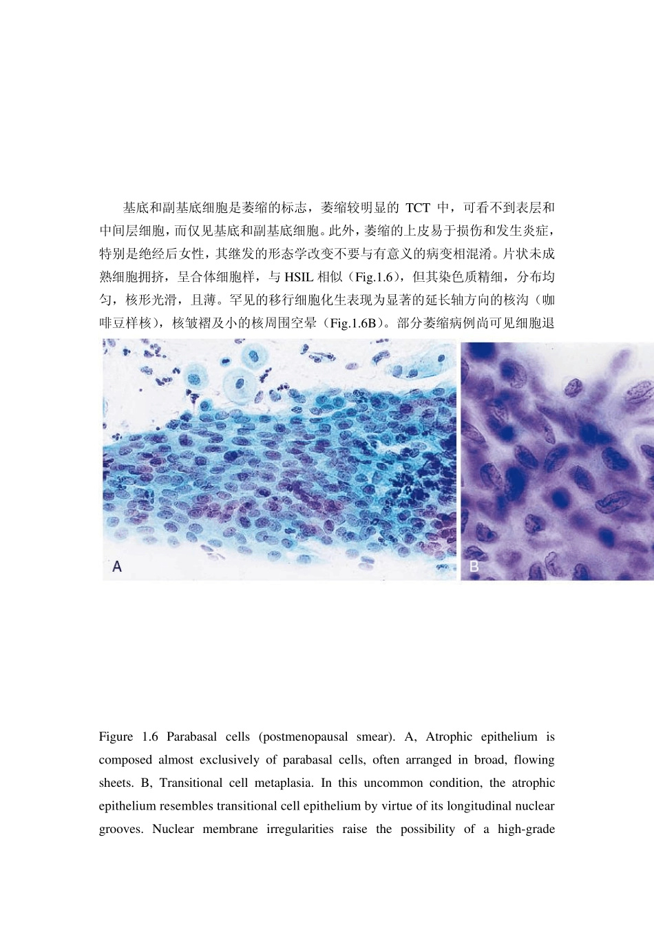 宫颈液基细胞学_第3页