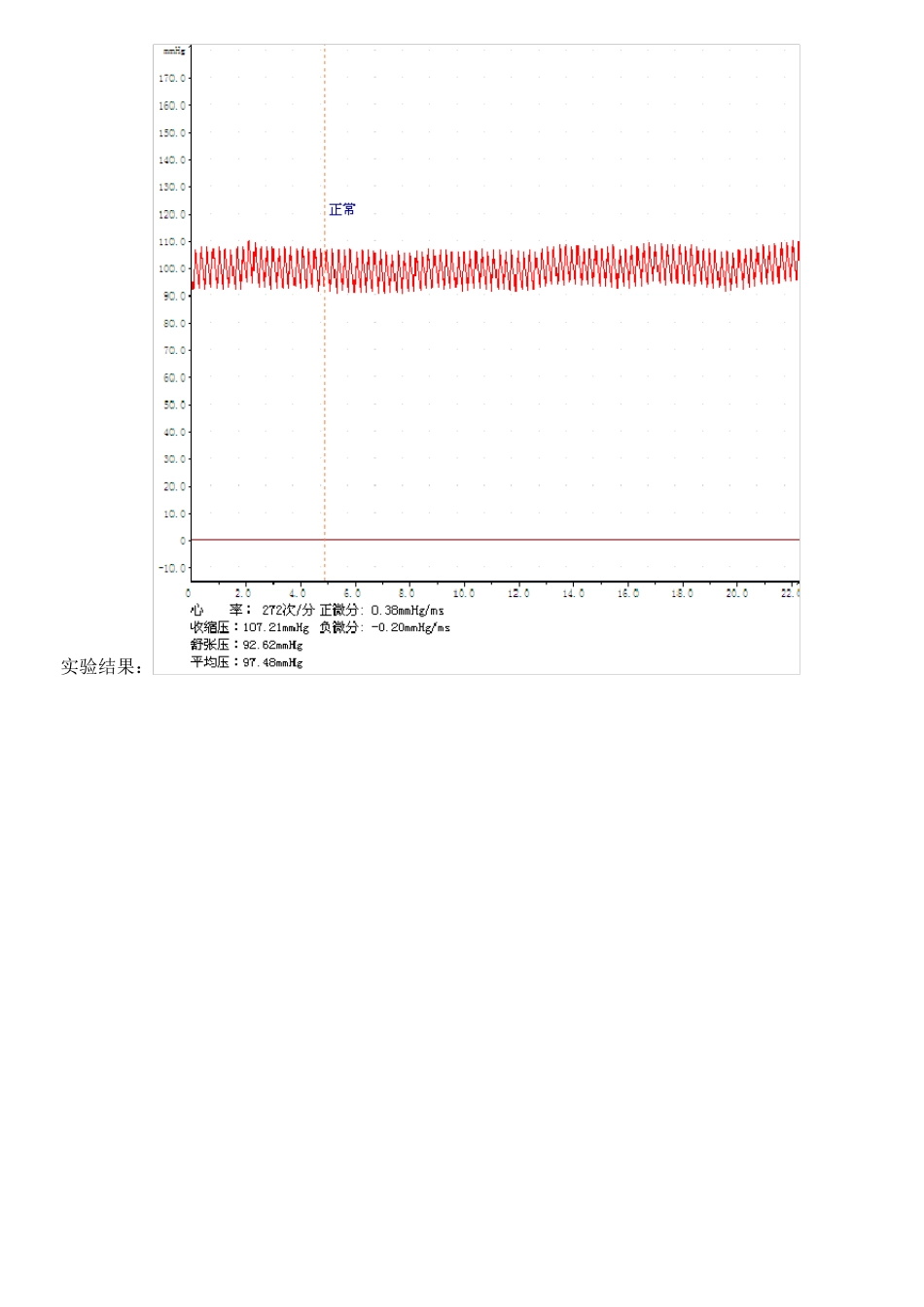 家兔血压调节实验报告_第3页