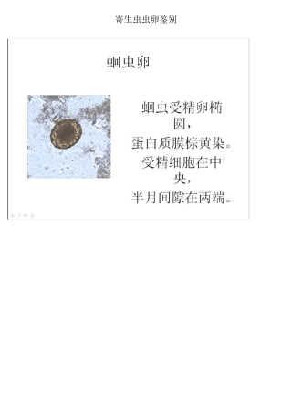 寄生虫虫卵鉴别,重点总结