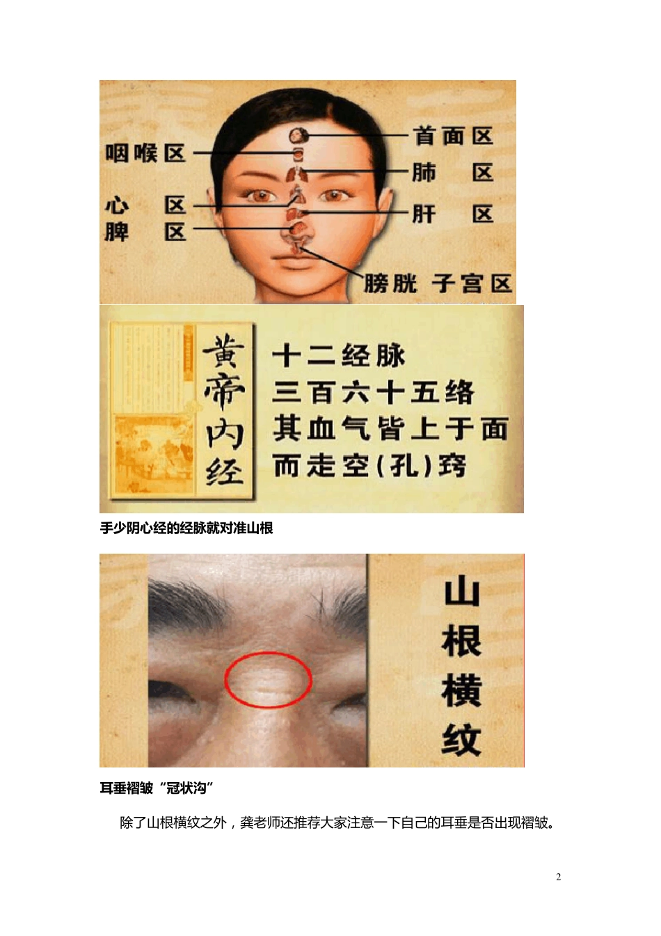 察颜观色辨心病(山根横纹,耳垂褶皱,益气保心汤配方,护心凉茶配方)_第2页