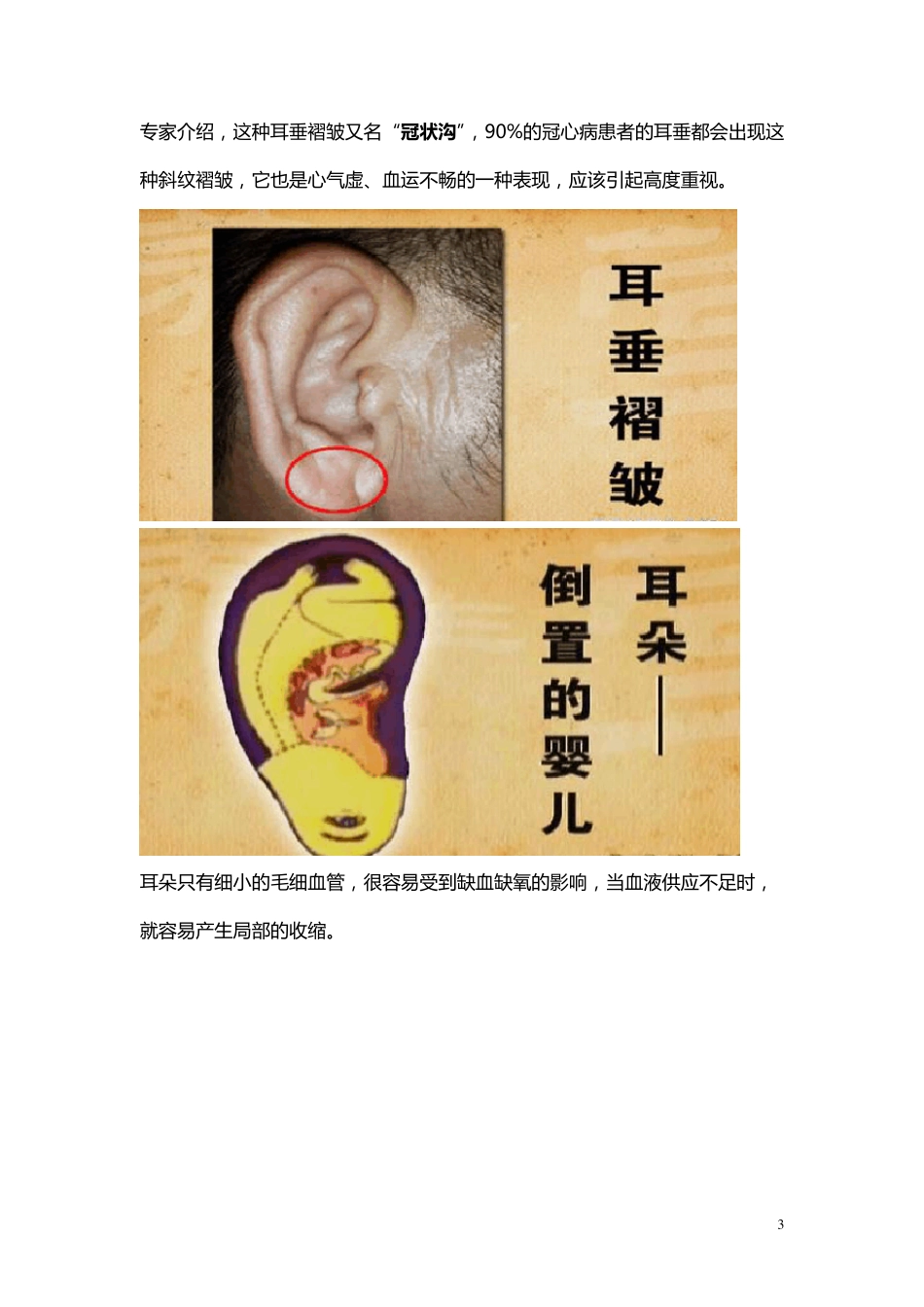 察颜观色辨心病(山根横纹,耳垂褶皱,益气保心汤配方,护心凉茶配方)_第3页