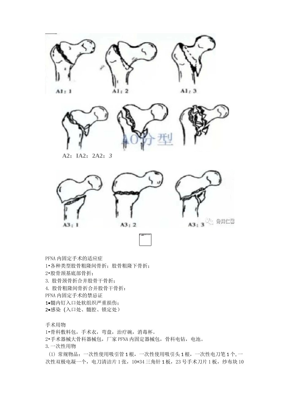 股骨粗隆间骨折PFNA内固定手术的护理配合_第2页