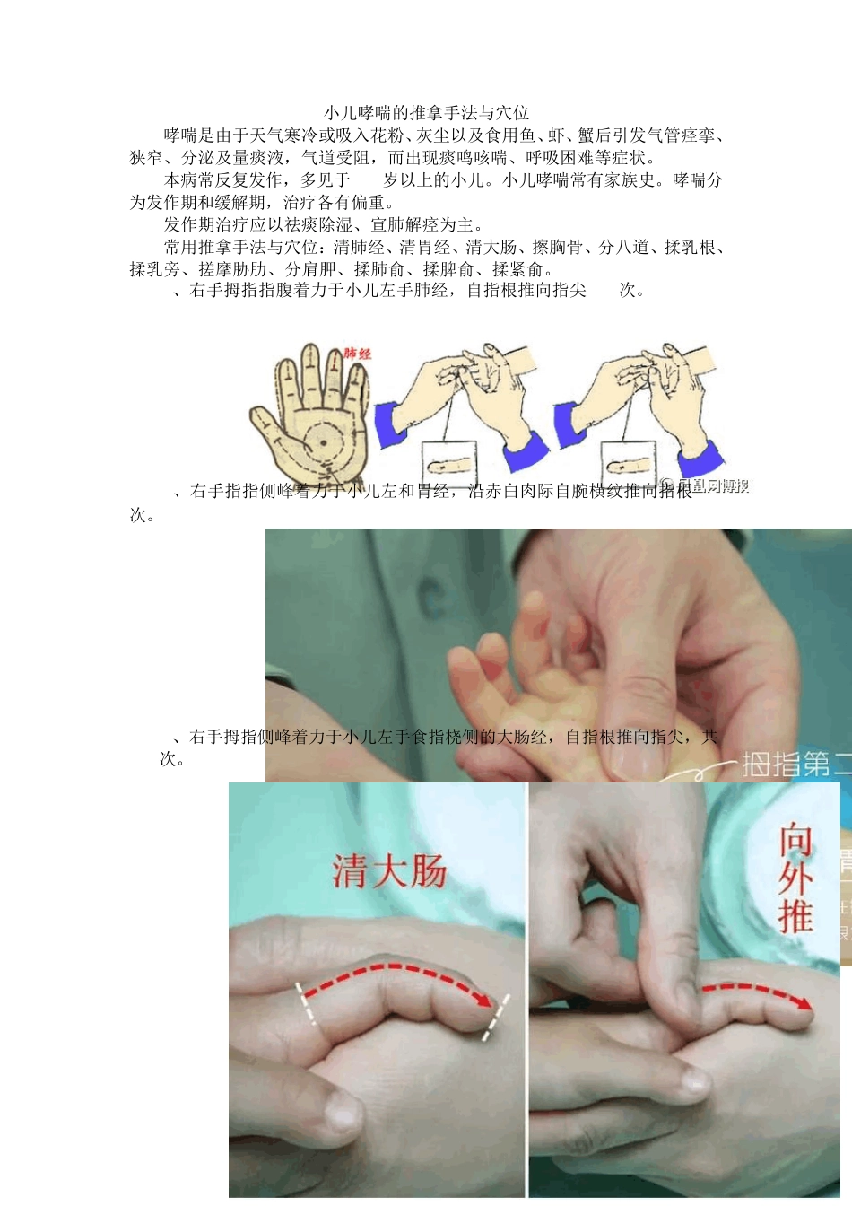 小儿哮喘的推拿手法与穴位(多图)_第1页