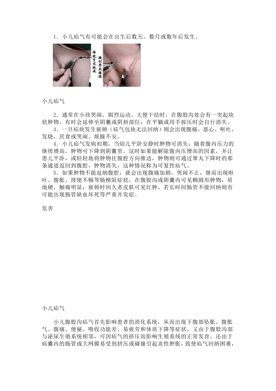 小儿疝气即小儿腹股沟疝气_第2页