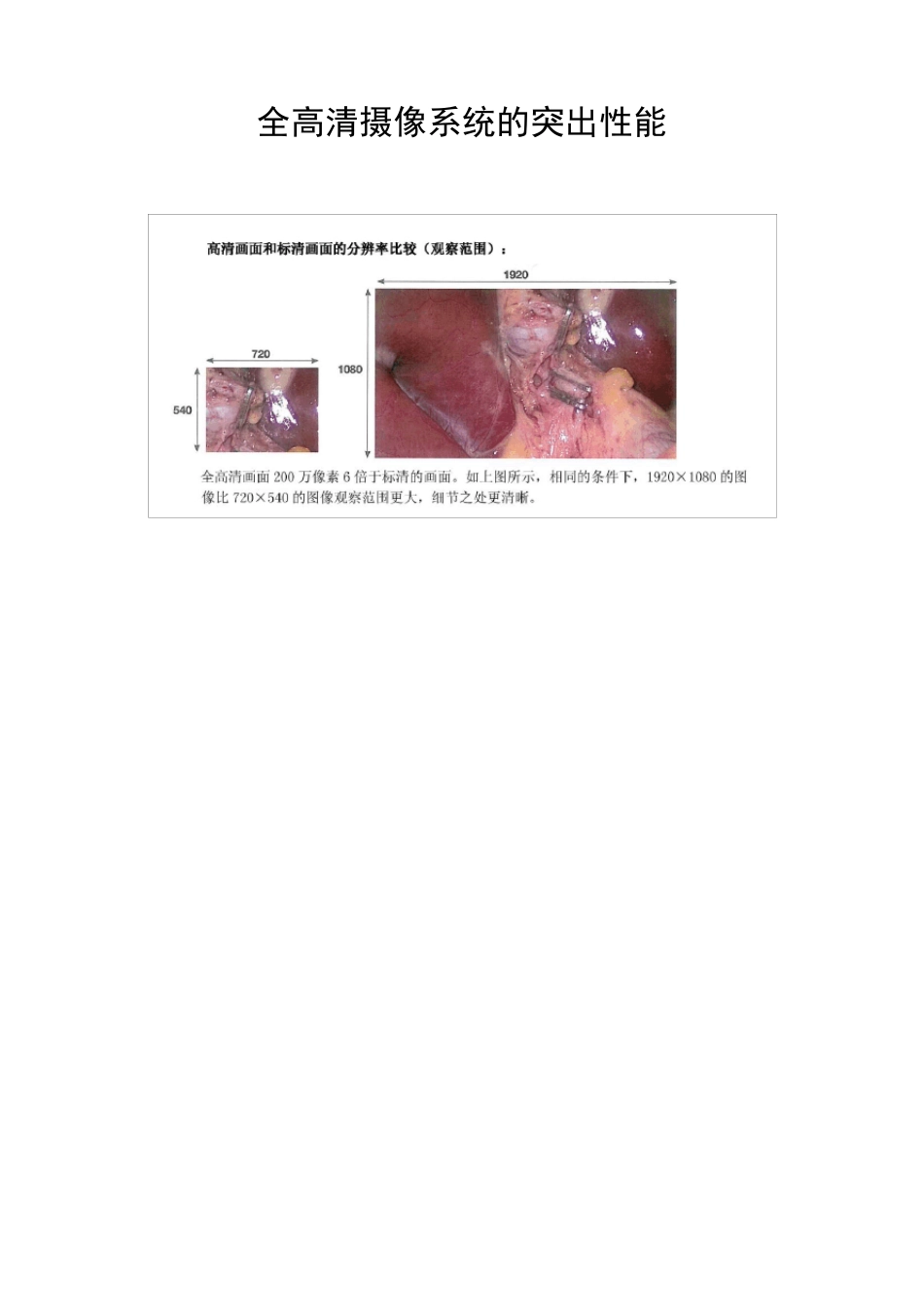 全高清内窥镜摄像系统相关资料_第2页