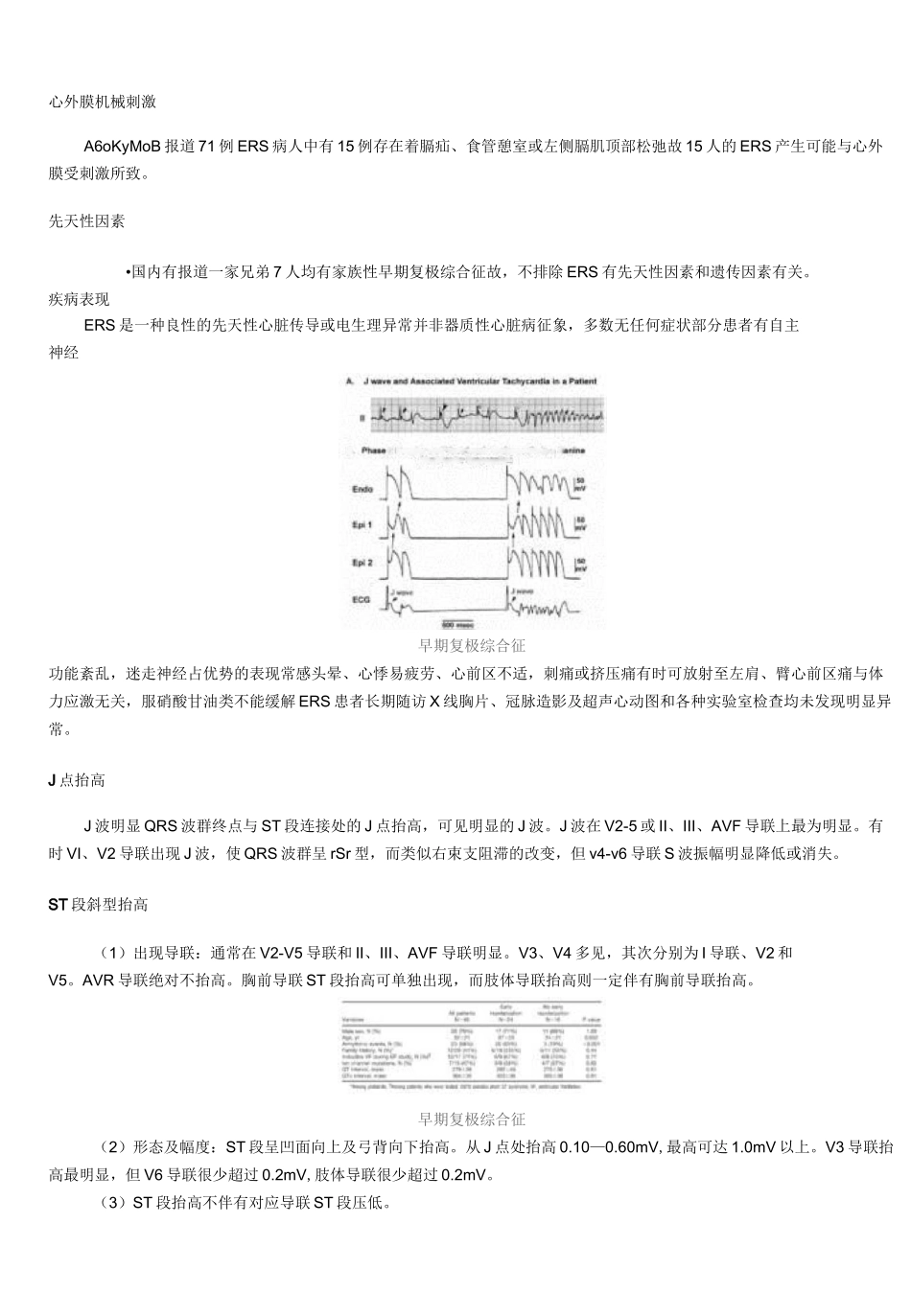 早期复极综合症_第3页