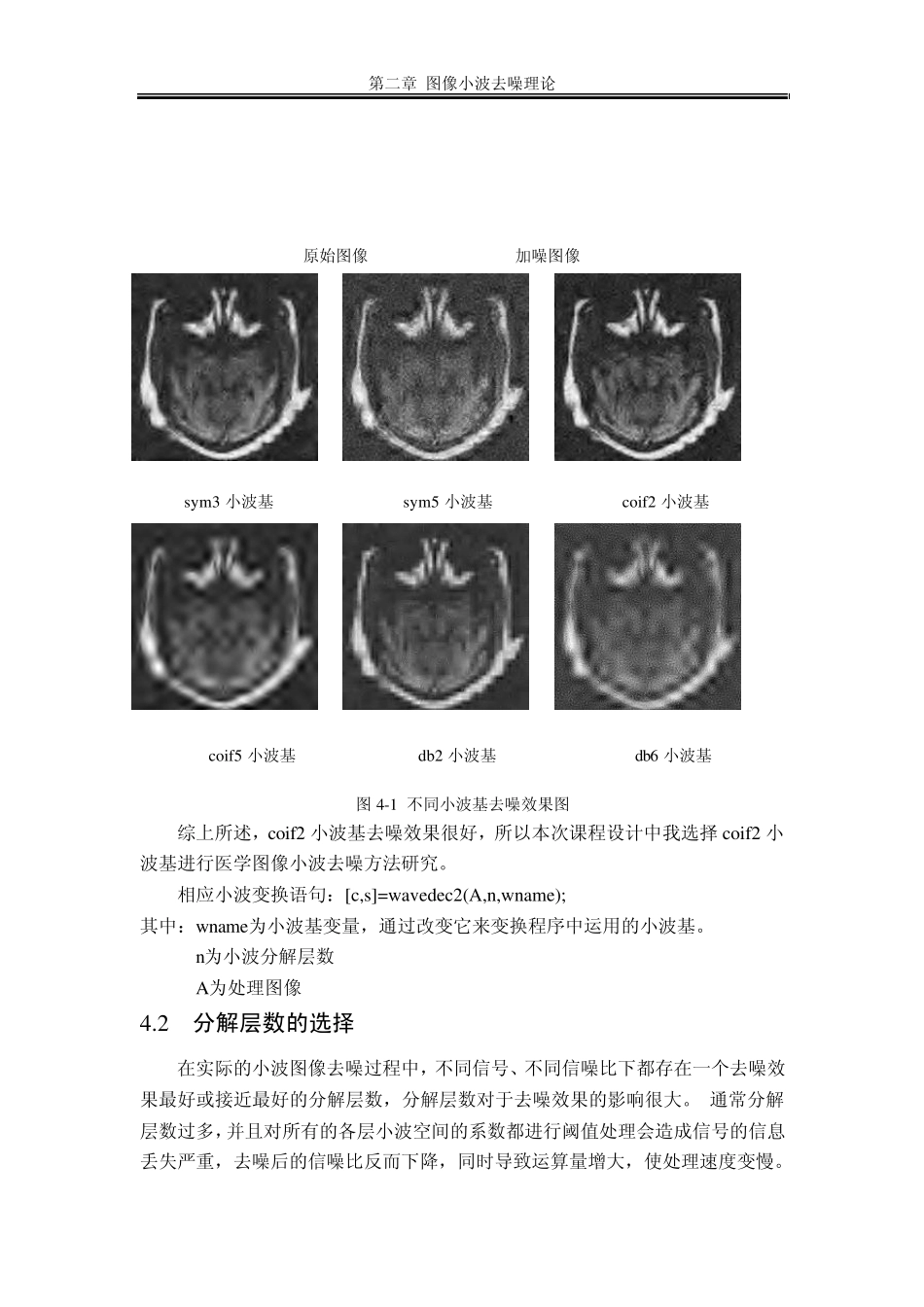 小波去噪MATLAB实现_第2页