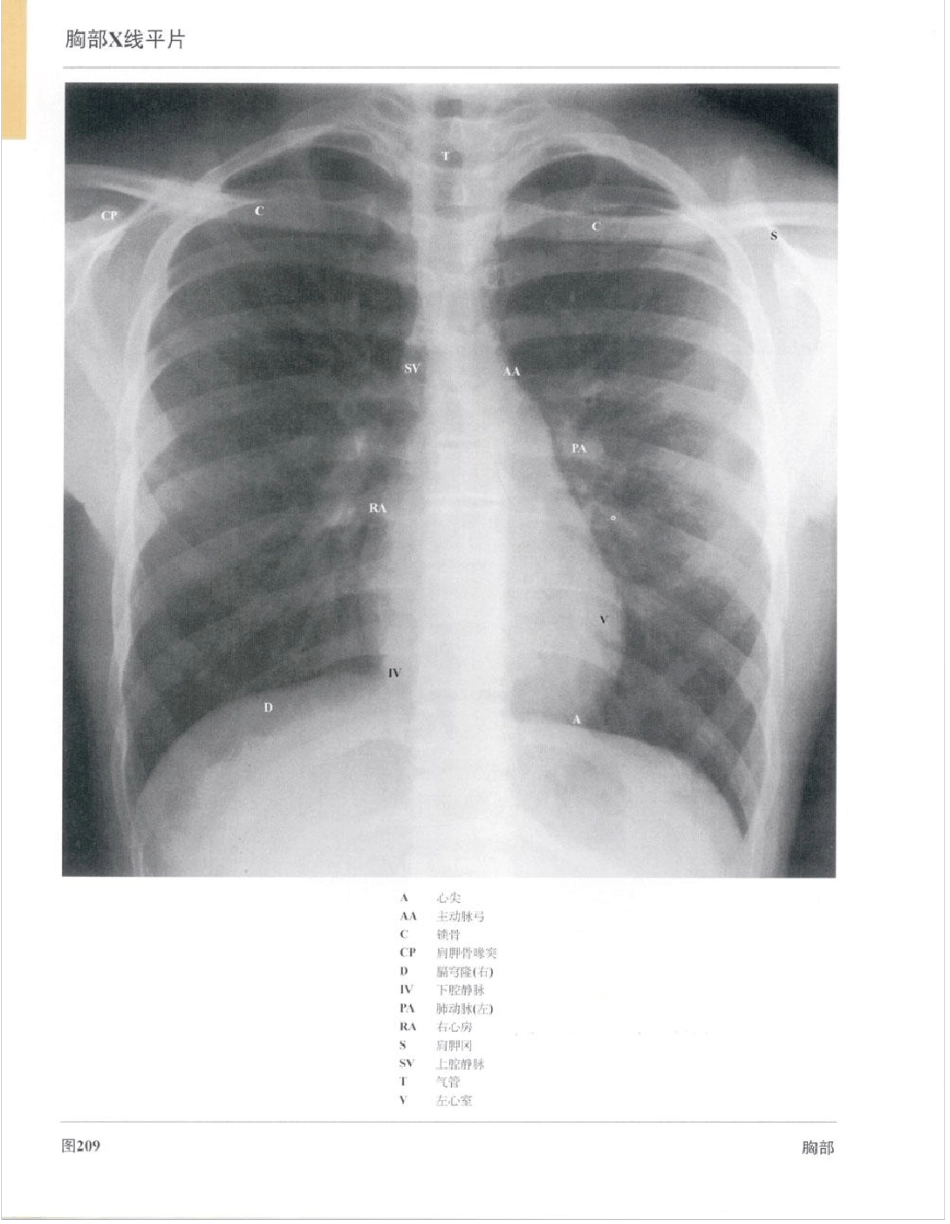 彩色人体心脏解剖图谱_第3页