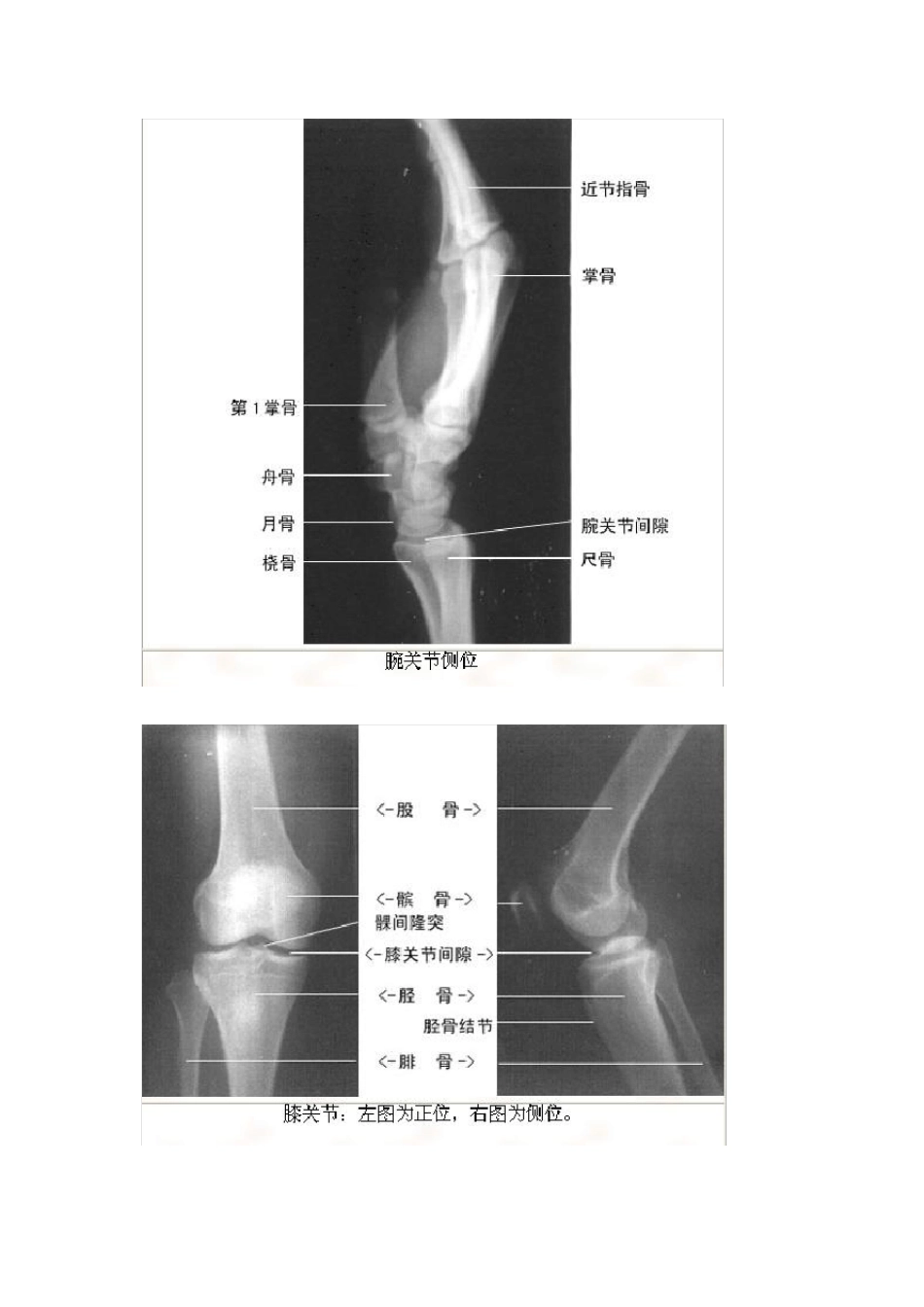 影像看片——X线解剖(绝版收藏)_第3页