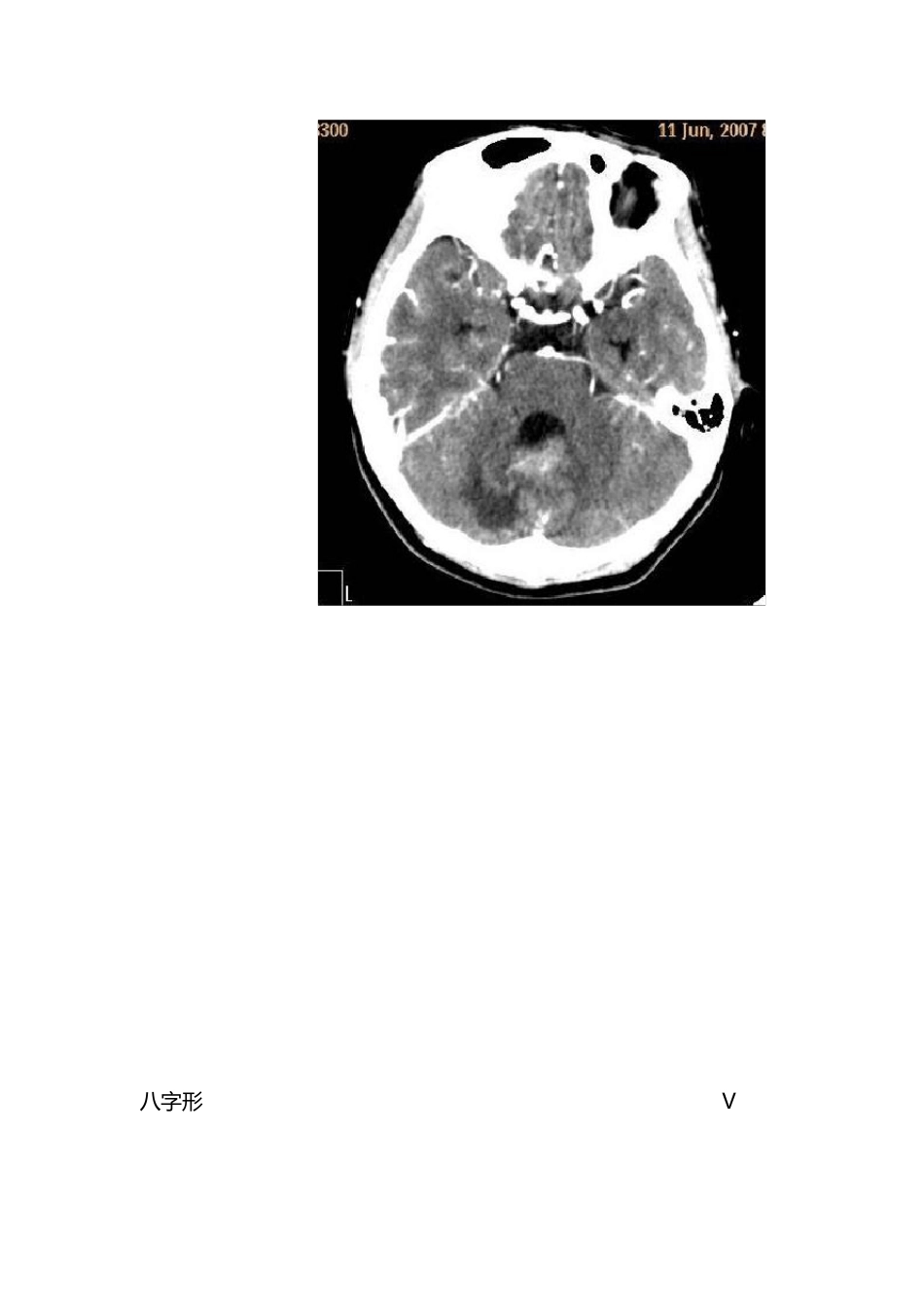 影像解剖学知识点_第2页