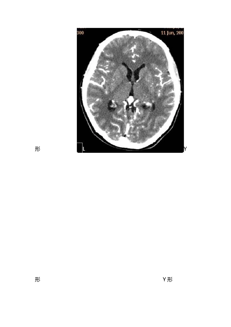 影像解剖学知识点_第3页