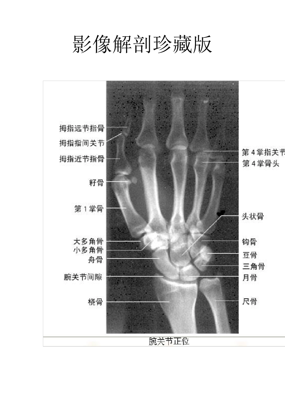 影像解剖影像图谱珍藏版_第1页