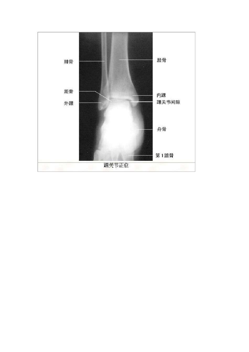 影像解剖影像图谱珍藏版_第3页