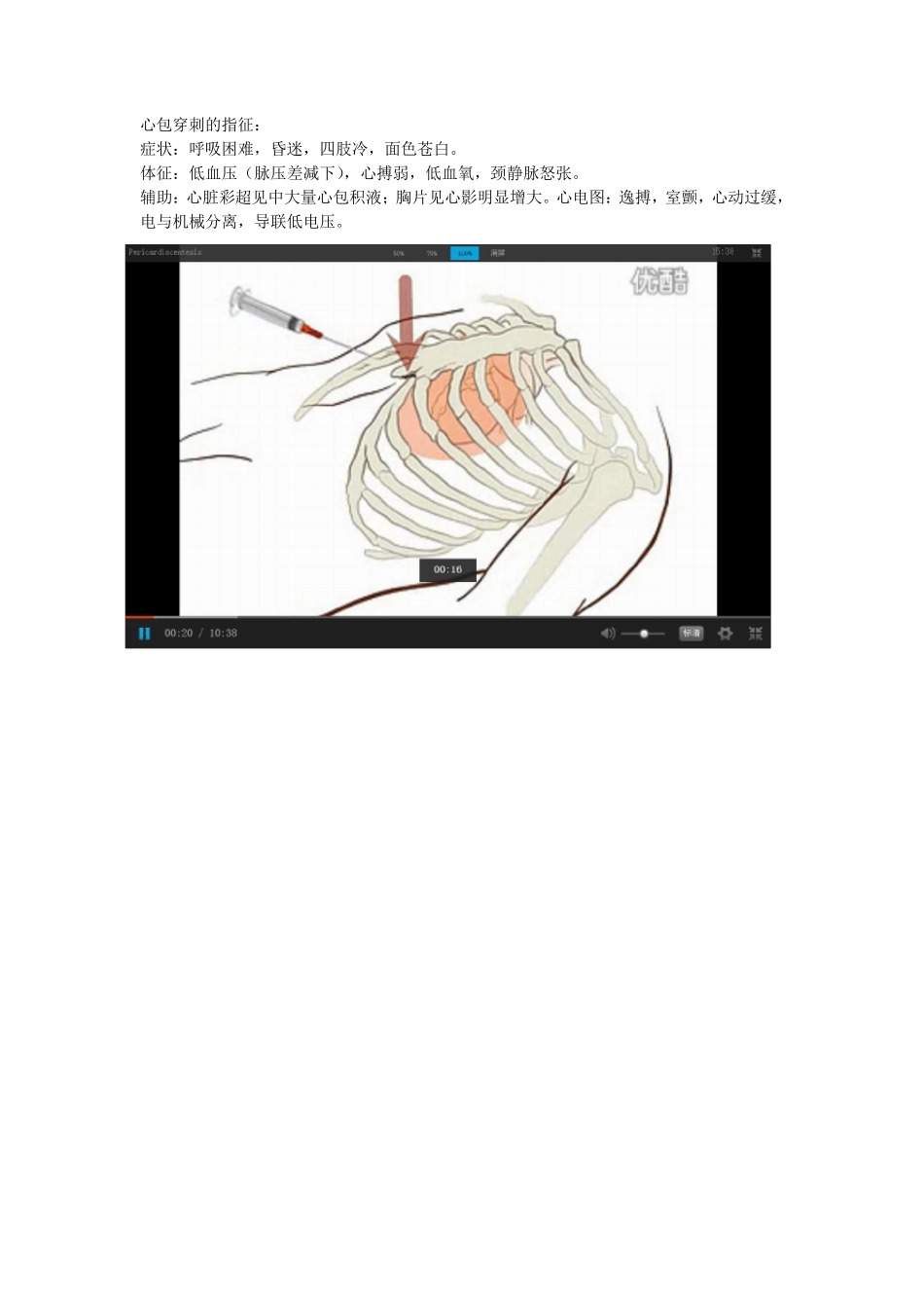 心包穿刺术视频图片集_第1页