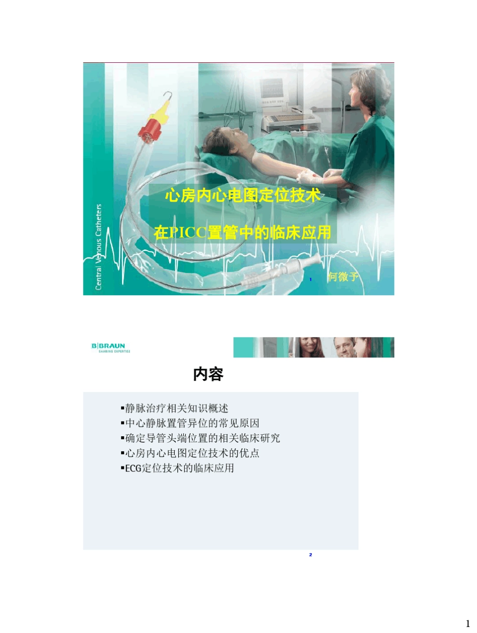 心房内心电图定位技术_第1页