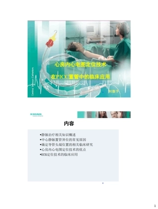 心房内心电图定位技术