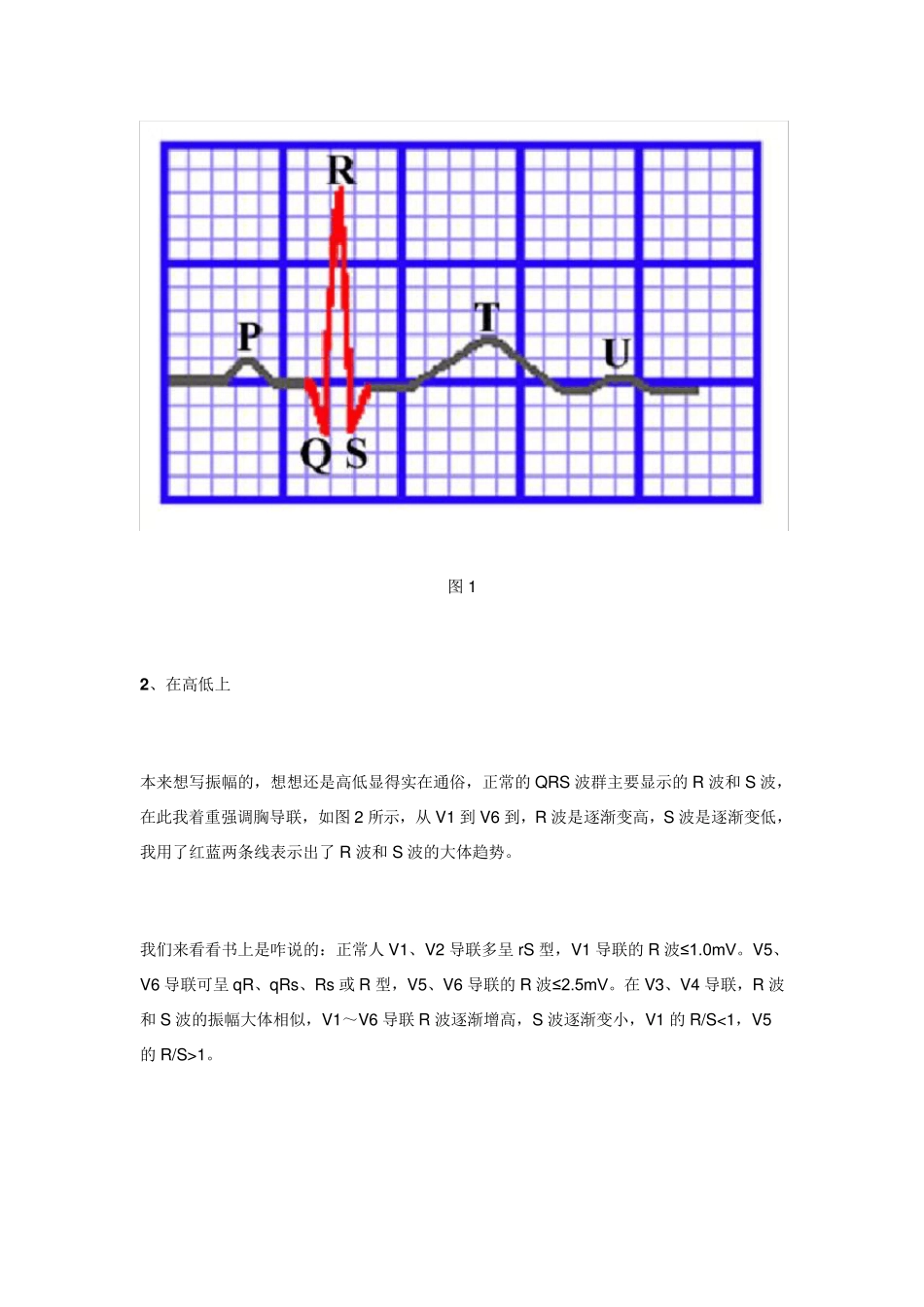 心电图QRS波群的五种_第2页