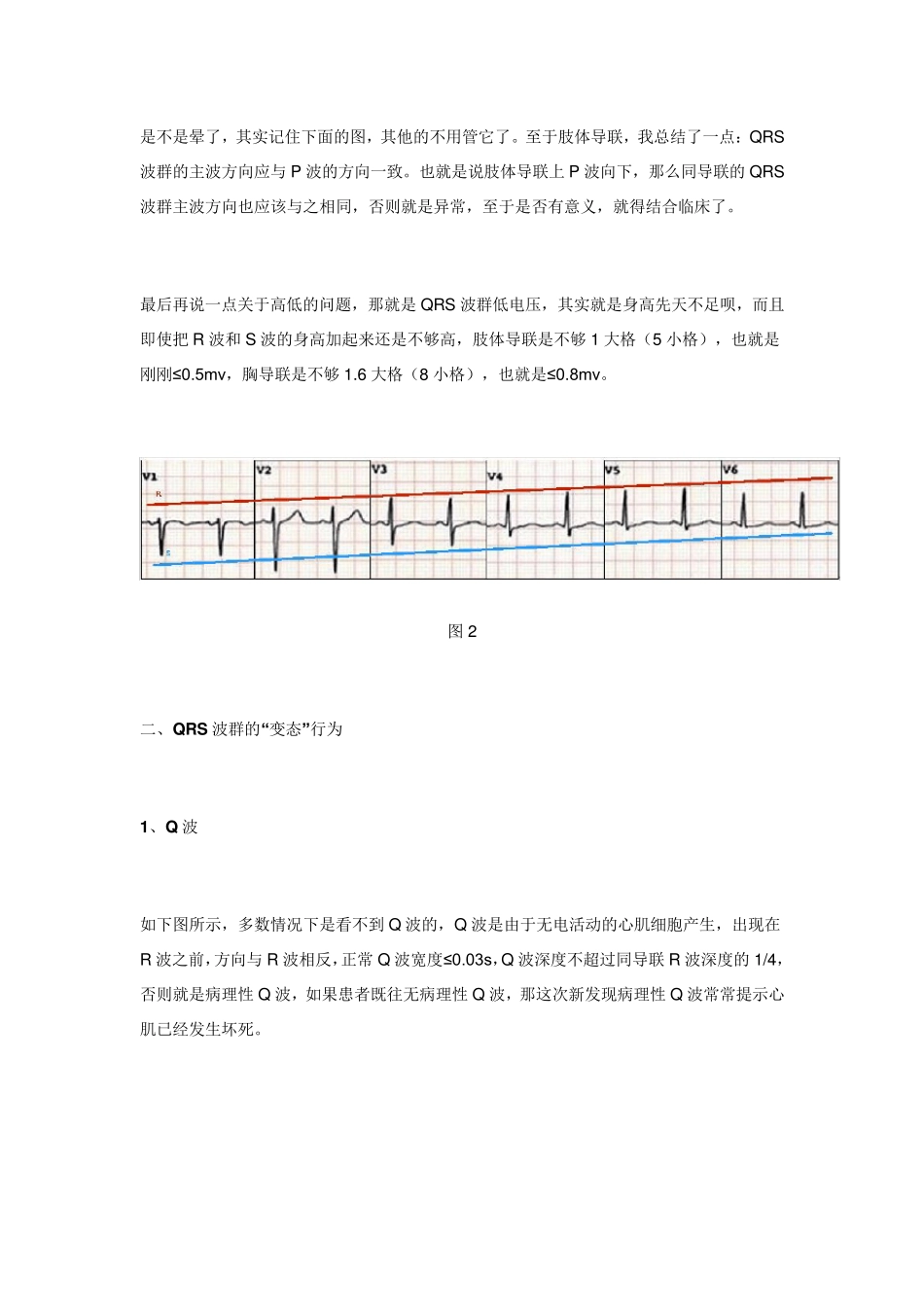 心电图QRS波群的五种_第3页