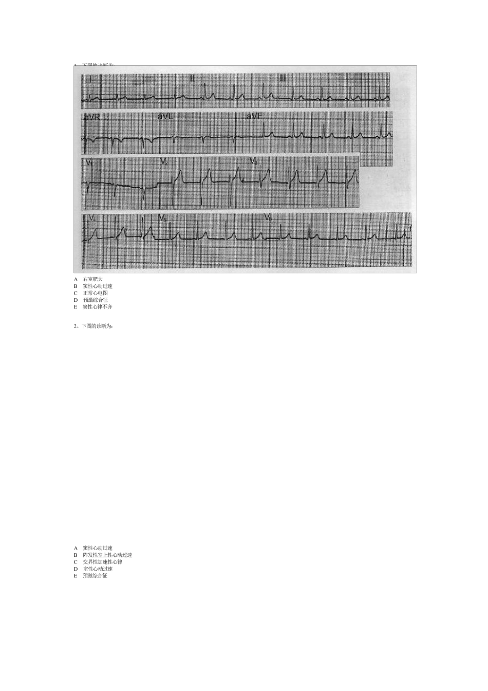 心电图习题(带图)_第1页