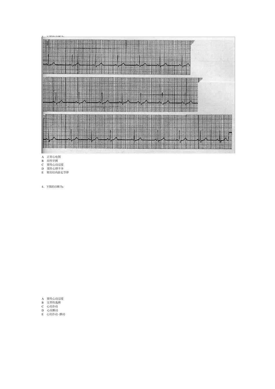 心电图习题(带图)_第2页