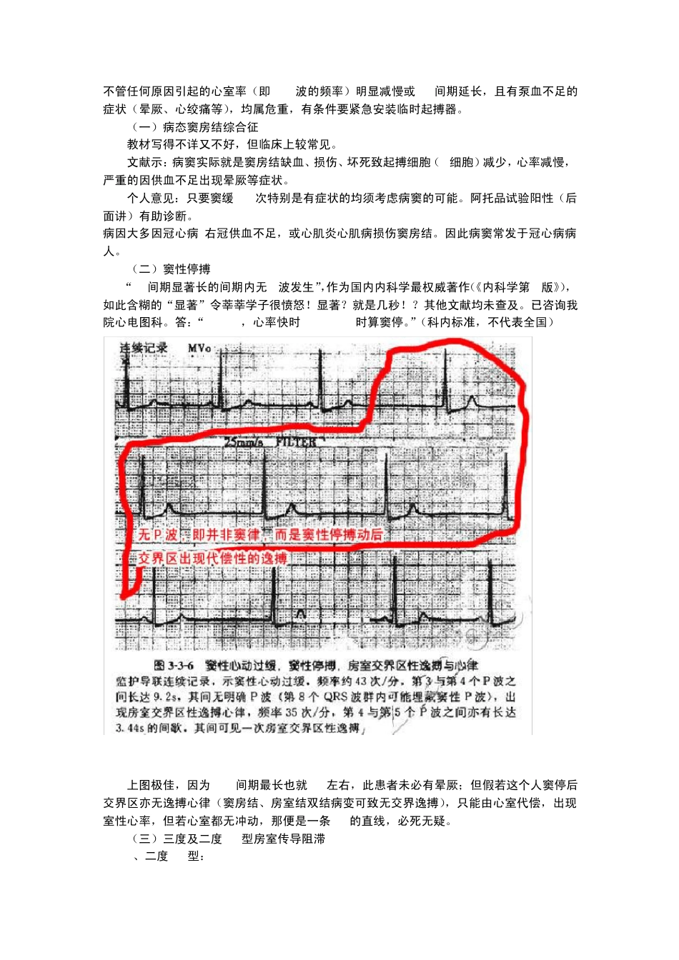 心电图原来也可以这么简单看看吧_第1页