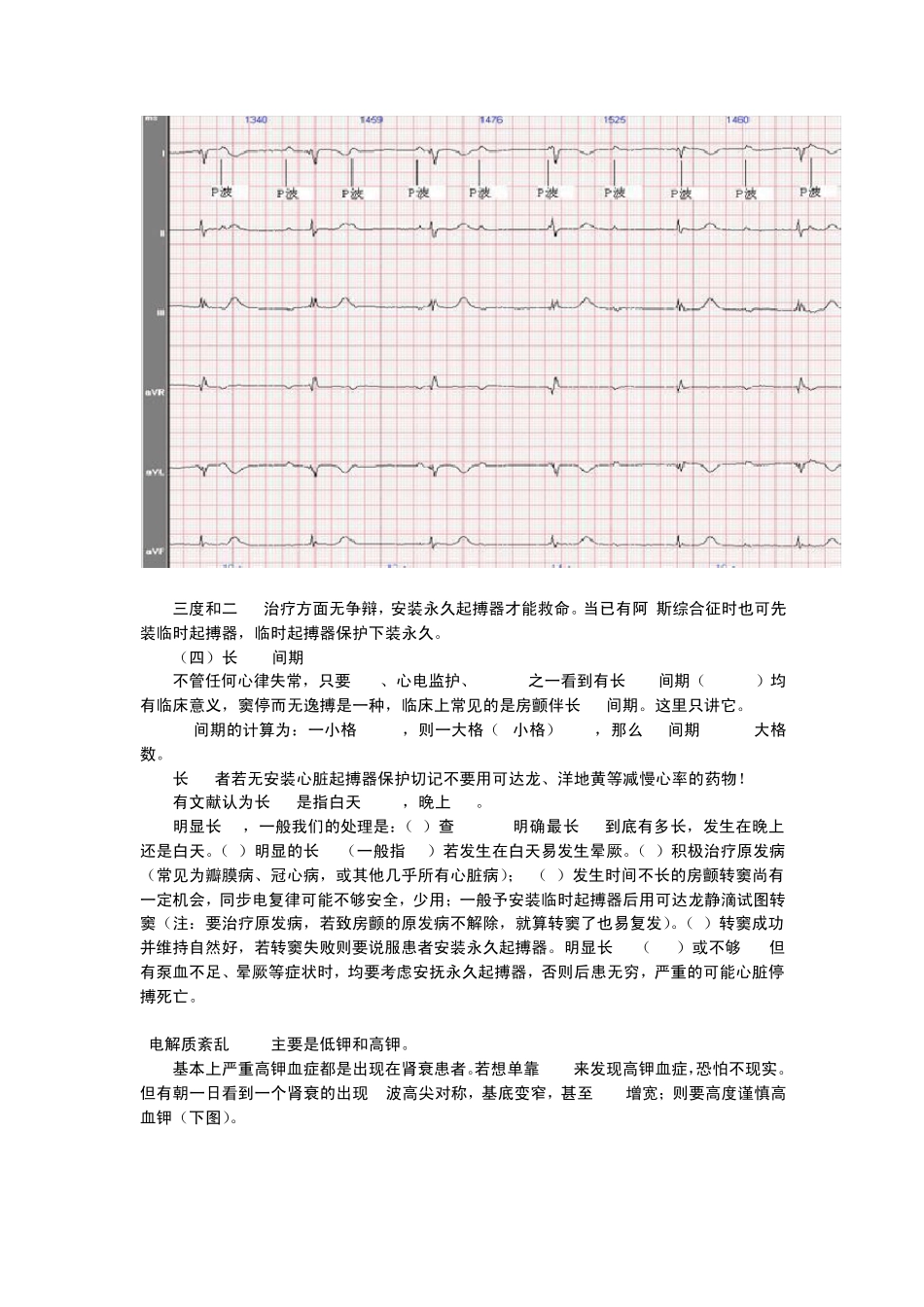 心电图原来也可以这么简单看看吧_第3页