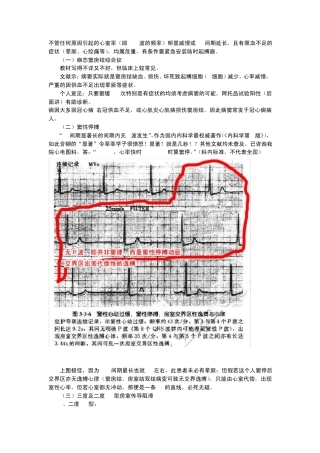 心电图原来也可以这么简单看看吧