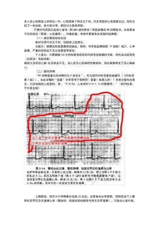 心电图基本讲解