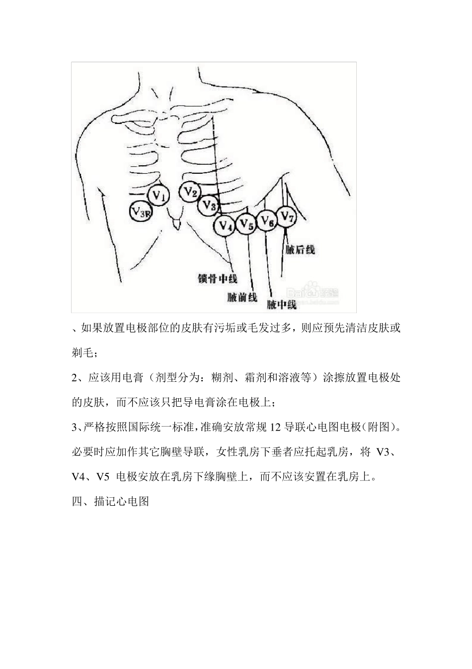 心电图操作要求及注意事项_第3页