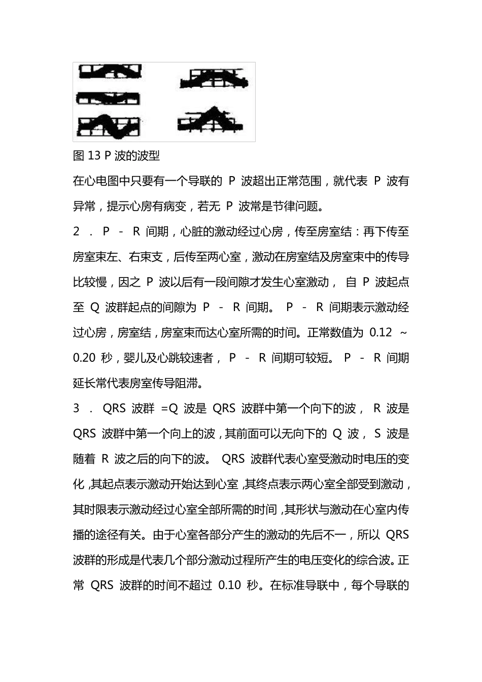 心电图的波形及各部分的意义_第2页