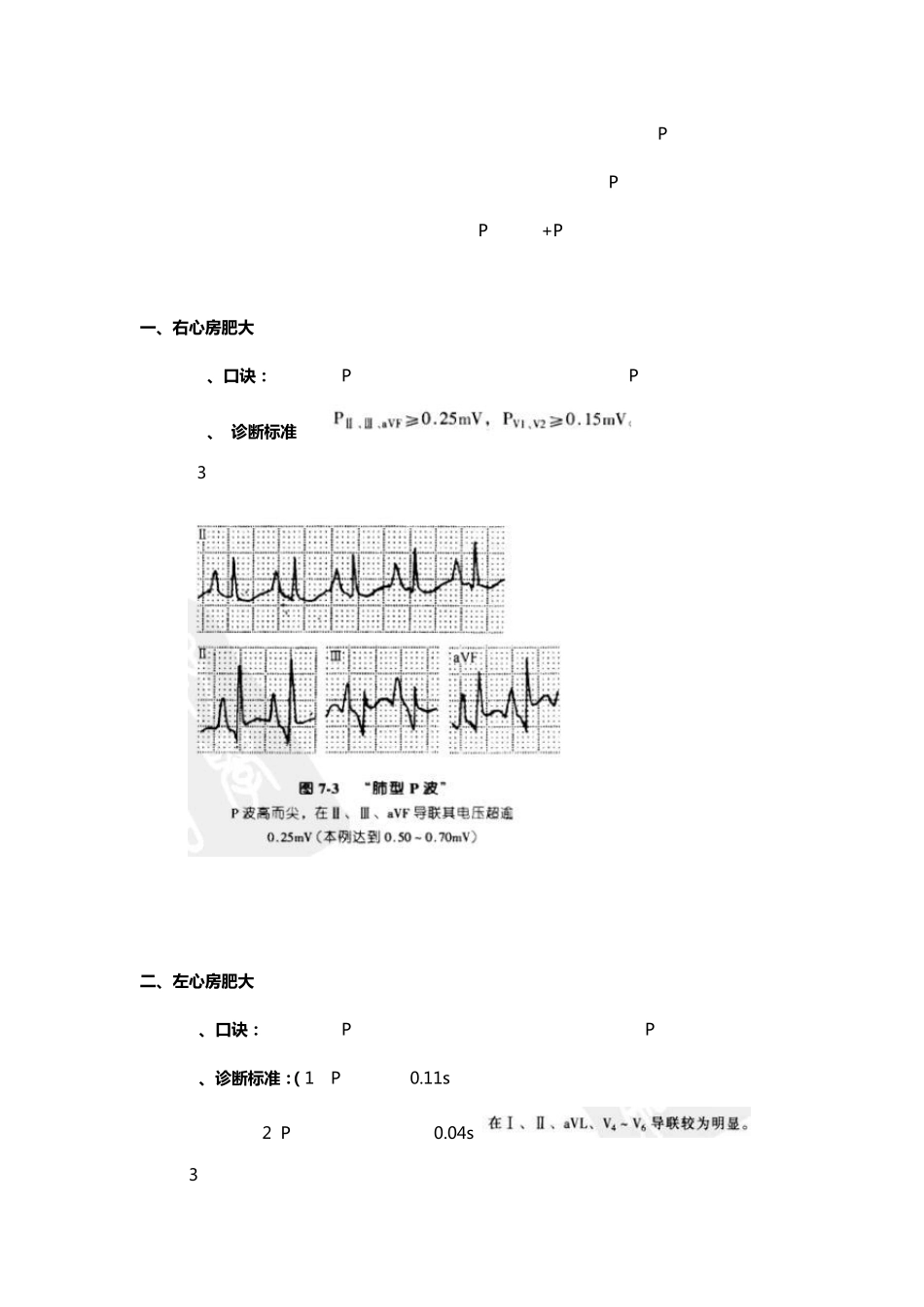 心电图第一讲：右房大、左房大和双房大_第2页