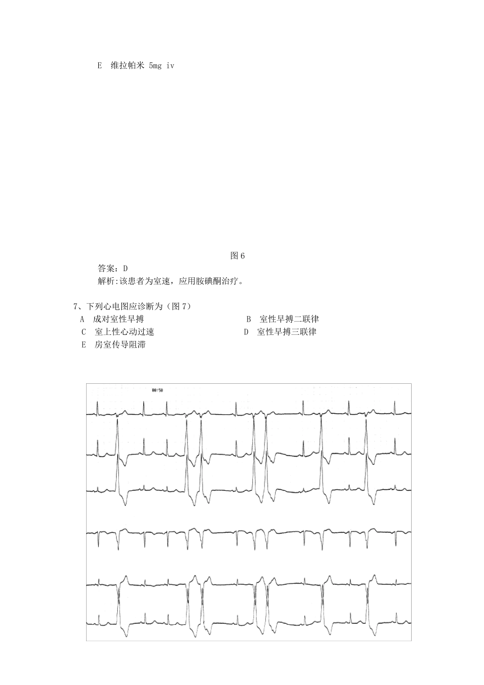 心电图精华50题_第3页