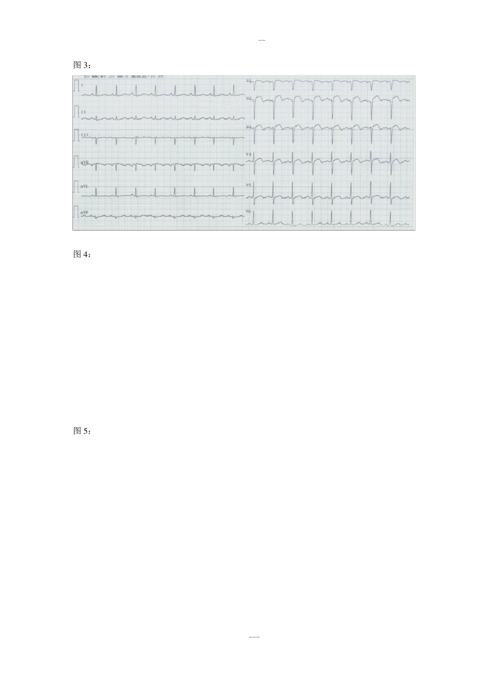 心电图试题与标准答案_第2页