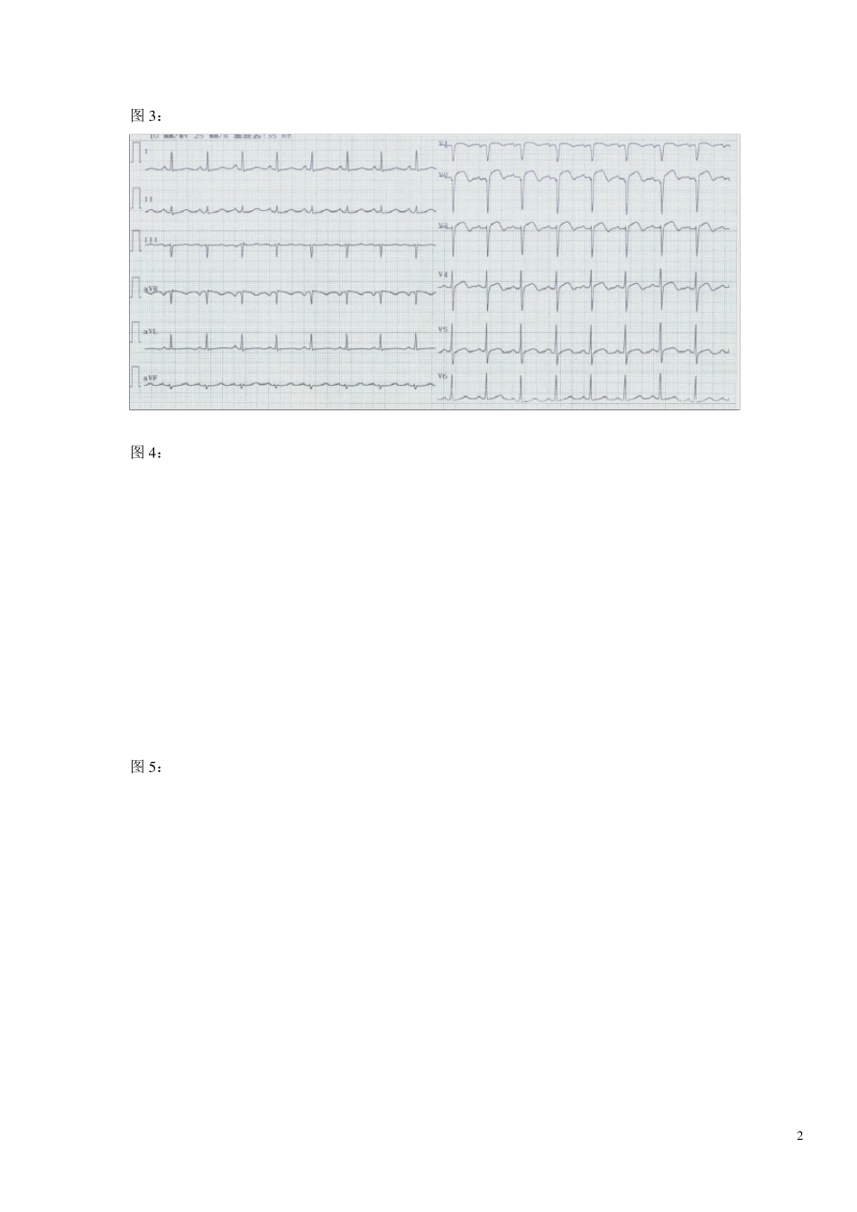 心电图试题及标准答案_第2页