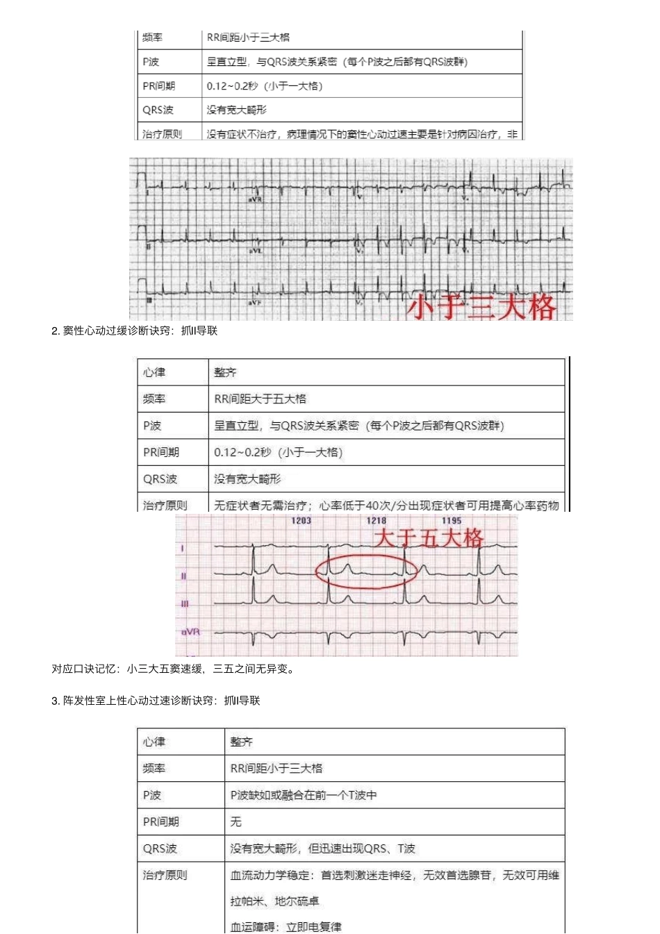 心电图速记口诀,赶快收藏起来吧_第3页
