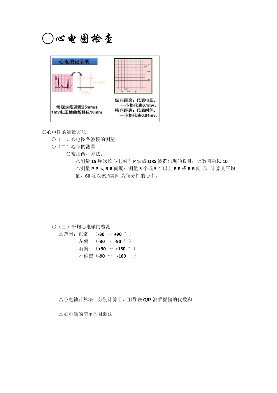 心电图重点知识总结_第3页