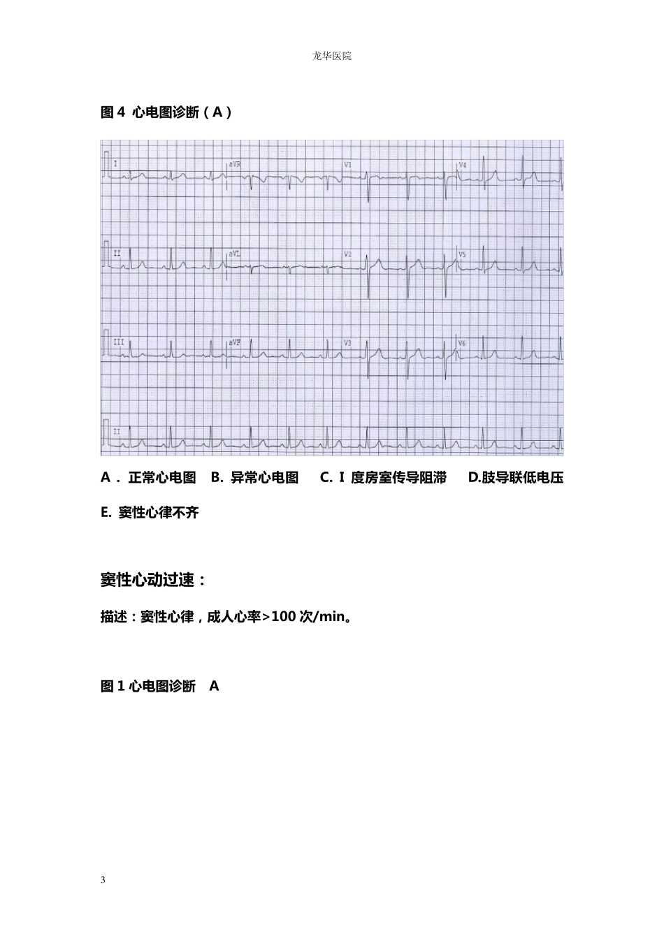 心电图读片习题_第3页