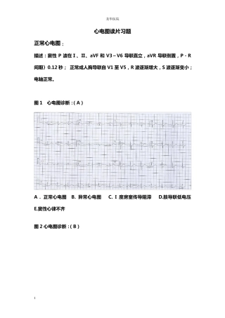 心电图读片习题