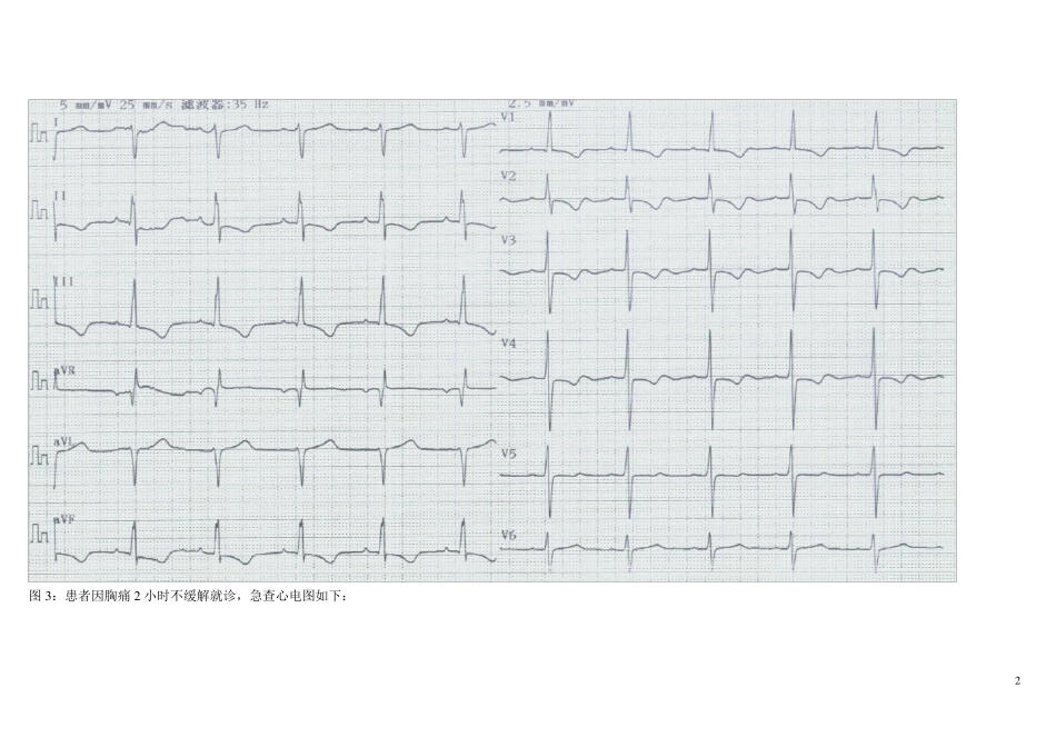 心电图阅图试题14题及答案_第2页