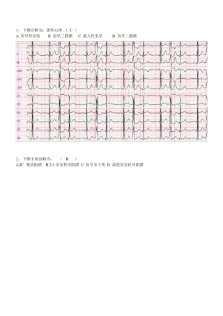 心电题试题(识图)