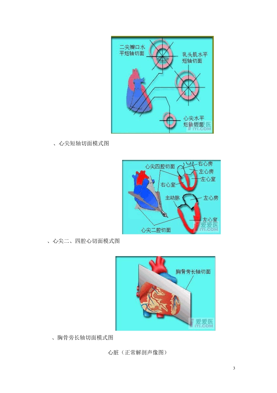 心脏(正常解剖模式图及超声声像图)_第3页