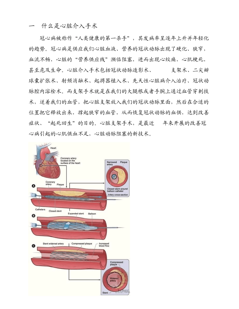 心脏介入简介_第1页