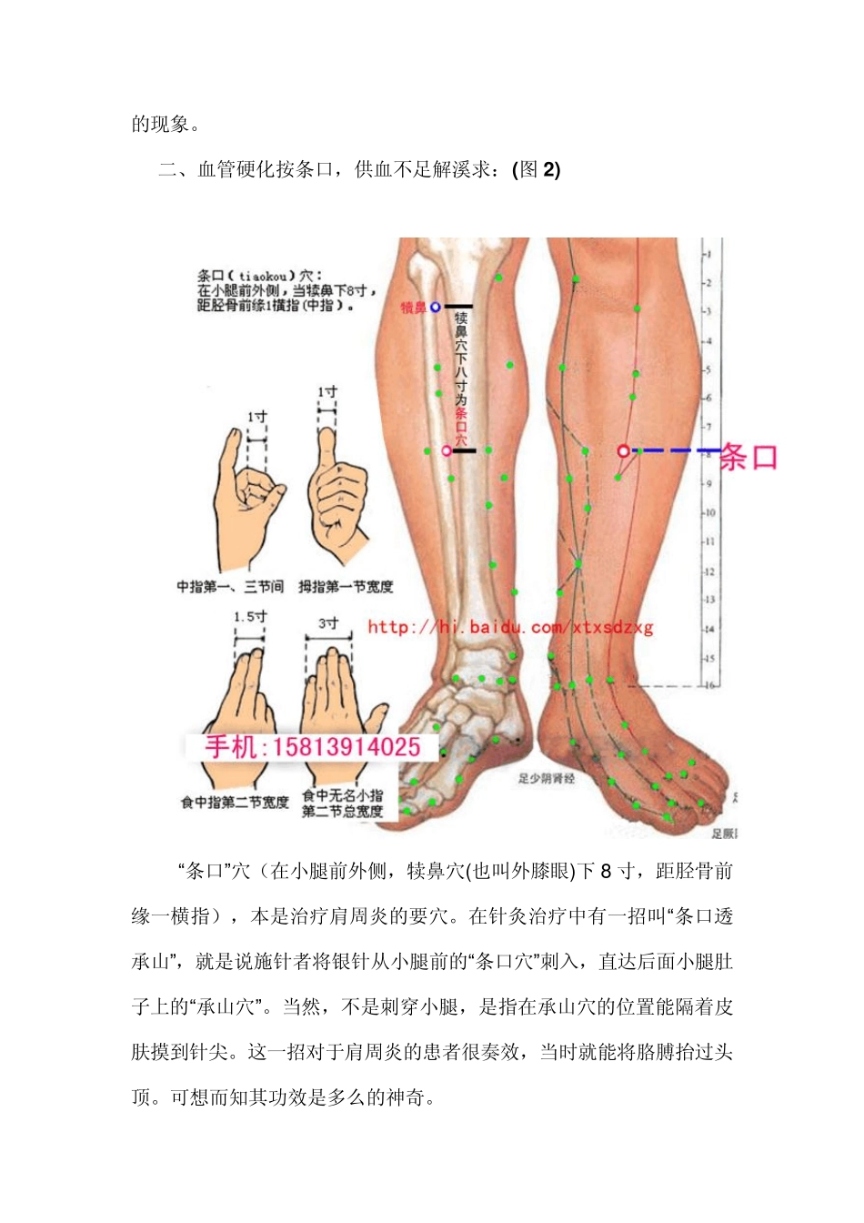 心脏病治疗口诀并附图谱_第3页