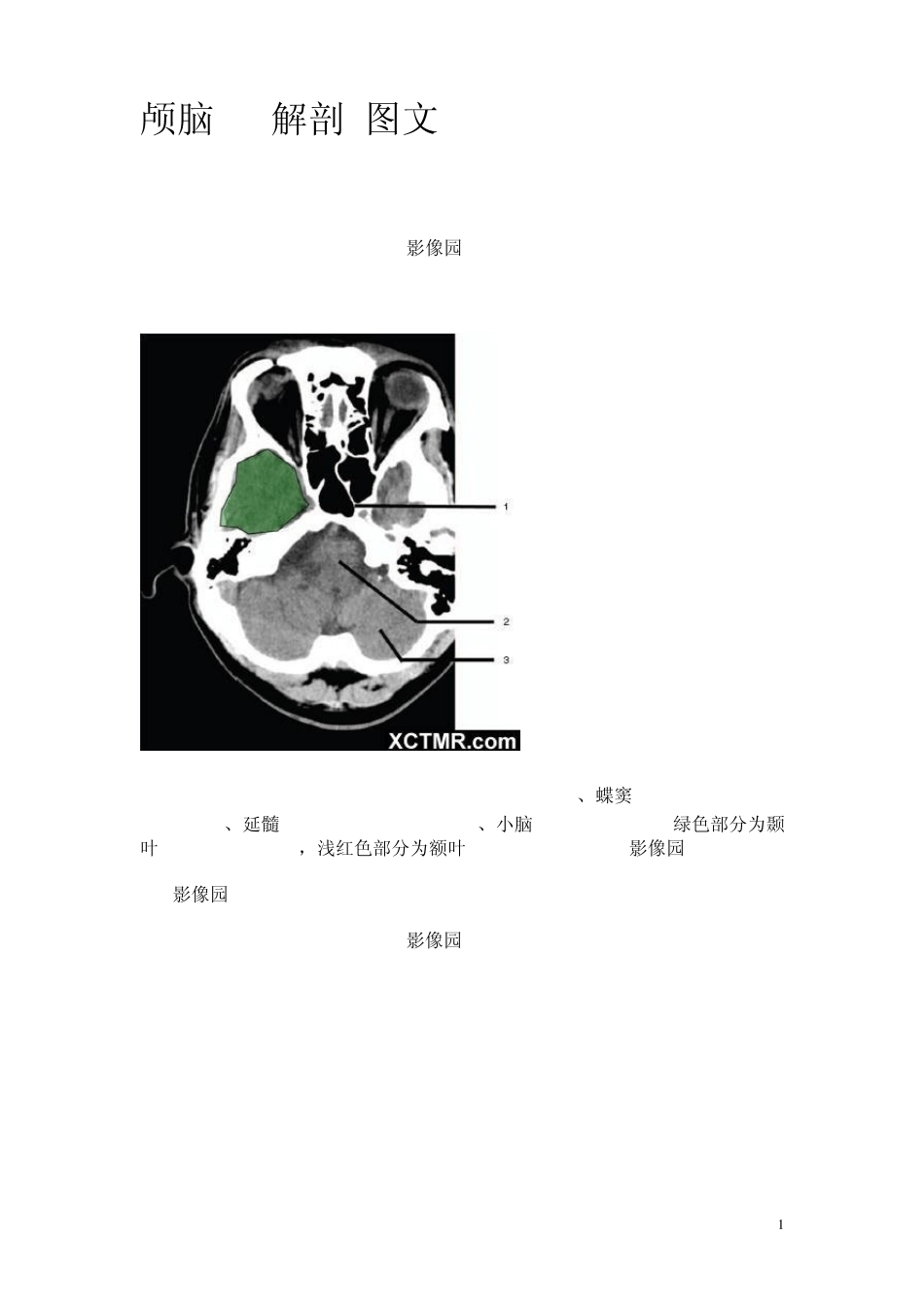 怎么看头部CT_第1页