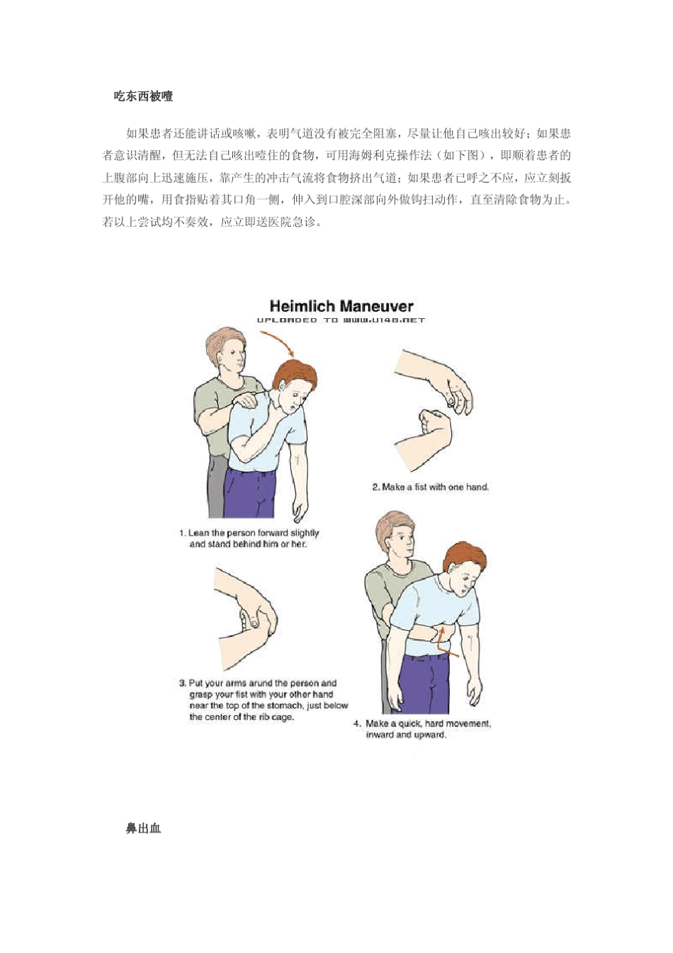 急救小常识简单却能救命_第2页