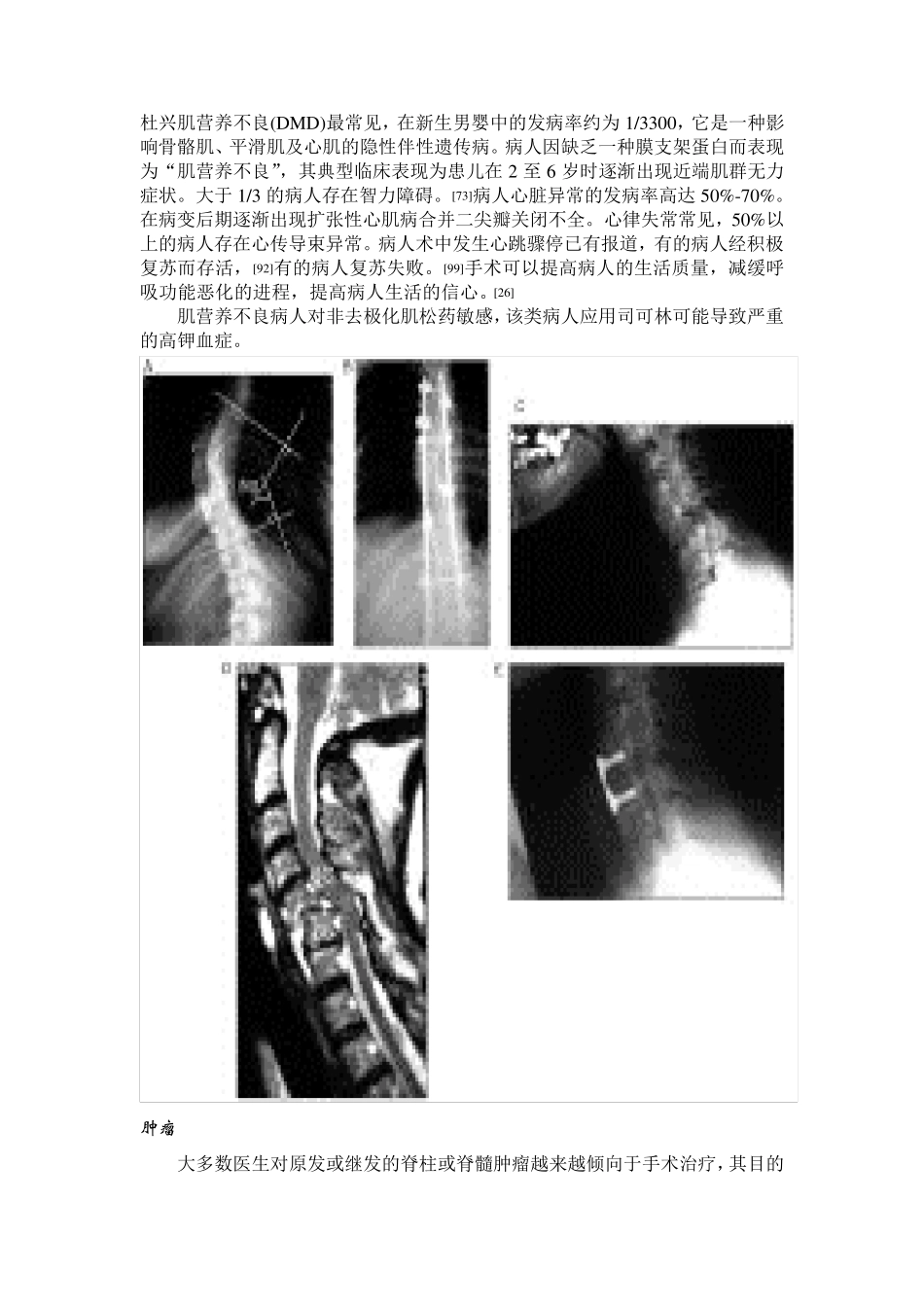 成人脊柱手术的麻醉_第2页