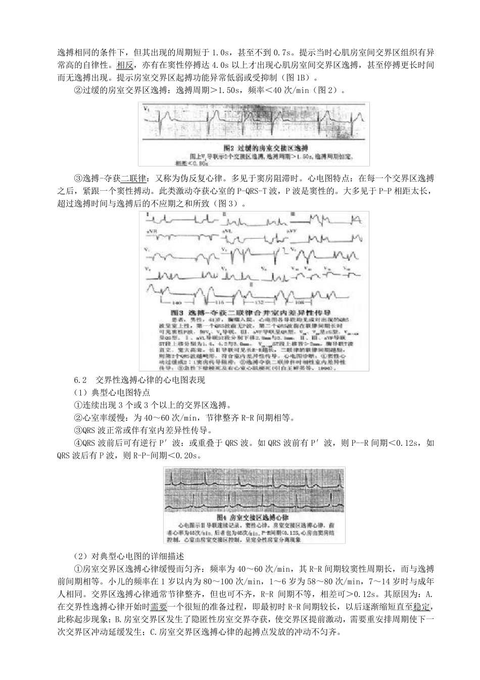 房室交界性逸搏和逸搏心律_第3页